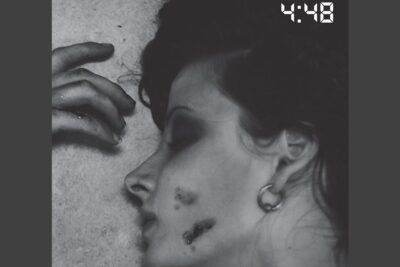 Black-and-white close-up of a woman's side profile showing cheek abrasions and a 4:48 timestamp, aktiv dodshjalp 6
