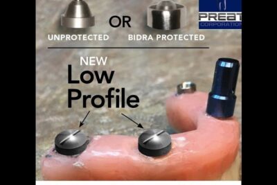 A pink denture base with two low profile metal attachments showing bidra a 2