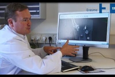 Medical professional in a white coat pointing at an X-ray on a monitor during a chirurgie plastique 1 consultation.