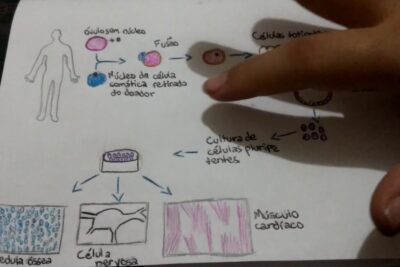 Hand-drawn educational diagram of therapeutic cloning process with labels and finger pointing, clonagem terapeutica 1