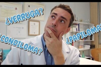 Clinician in white coat thinking with on-image questions about el condiloma 1 and similar skin lesions