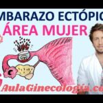 Riesgos médicos del aborto: Impactantes argumentos en contra que debes conocer