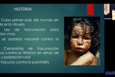 Spanish presentation slide showing historic vaccination milestones and a child with severe pox lesions, enfermedades prevenibles 1.