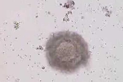 Microscopic round single-cell structure resembling an early embryo during fecundacion in 1