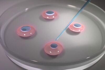 Close-up petri dish with four oocyte-like samples and a micropipette for fecundacion in vitro.