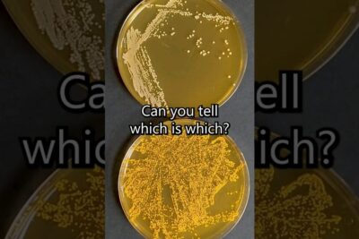 Two agar Petri dishes with contrasting yellow bacterial colonies, one sparse and one dense, genmodifiserte organismer 3