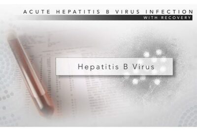 Blood vial and lab report with 'Hepatitis B Virus' title illustrating hepatitis b 2 testing.