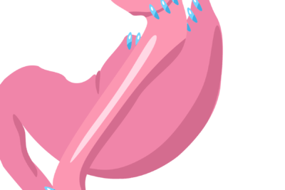 Stylized pink stomach and esophagus illustration with blue droplet accents, naturapressad apelsinjuice ja eller nej