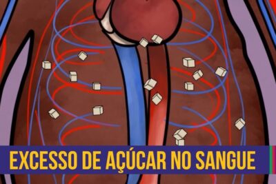 Stylized chest diagram with sugar cubes in blood vessels illustrating niveis acucar