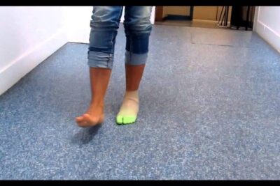 Lower legs walking indoors with a beige cosmetic foot cover protheses esthetiques 1