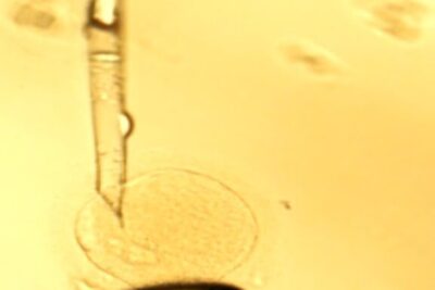 Microscopic image of a microinjection pipette delivering material into a single round cell, representing uso celulas tronco 1.