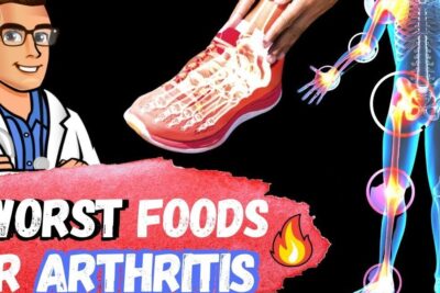 Graphic showing highlighted skeletal joints, a doctor illustration, and bold text about verzehr fast food as a worst food for arthritis