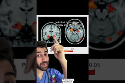 Medical professional in blue scrubs pointing at fMRI brain scans highlighting memory regions for vetenskaplig forskning