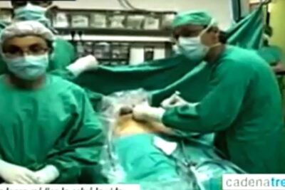 Surgical team in green scrubs performing a cesarean delivery with patient on the operating table vida feto 3.